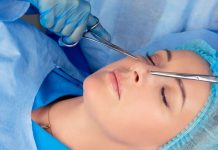 Your Guide to Nose Thread Lift in Singapore