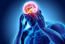 Is CBD Oil Effective for Migraine Pain Is CBD Oil Effective for Migraine Pain