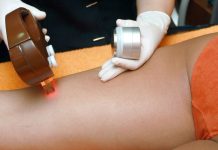 Why You Might Consider Hair Removal laser hair rem
